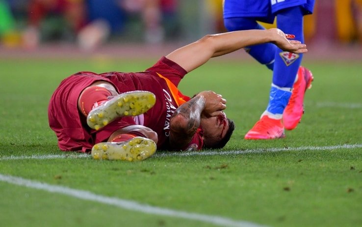 Roma, ecco la tegola: frattura del setto nasale per Pellegrini